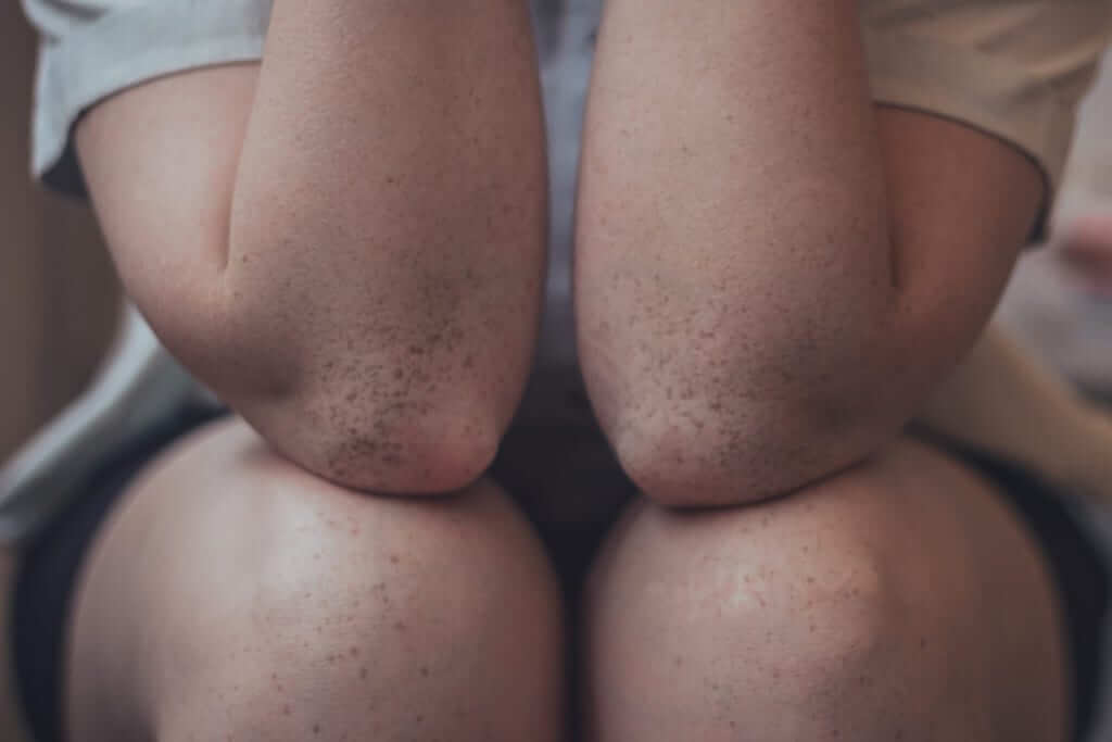 Elbows to demonstrate Dor de cotovelo