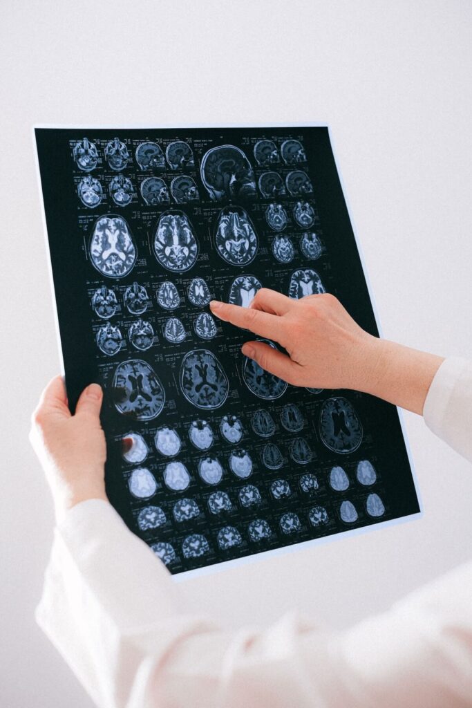 doctor pointing to brain MRI scan